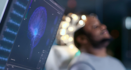 Microesoni e sonno: scoperto un regolatore dell�attivit� cerebrale